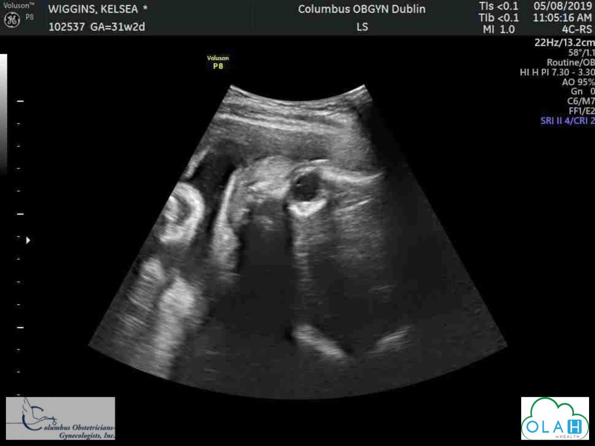 37 Weeks and 2&nbsp;Days