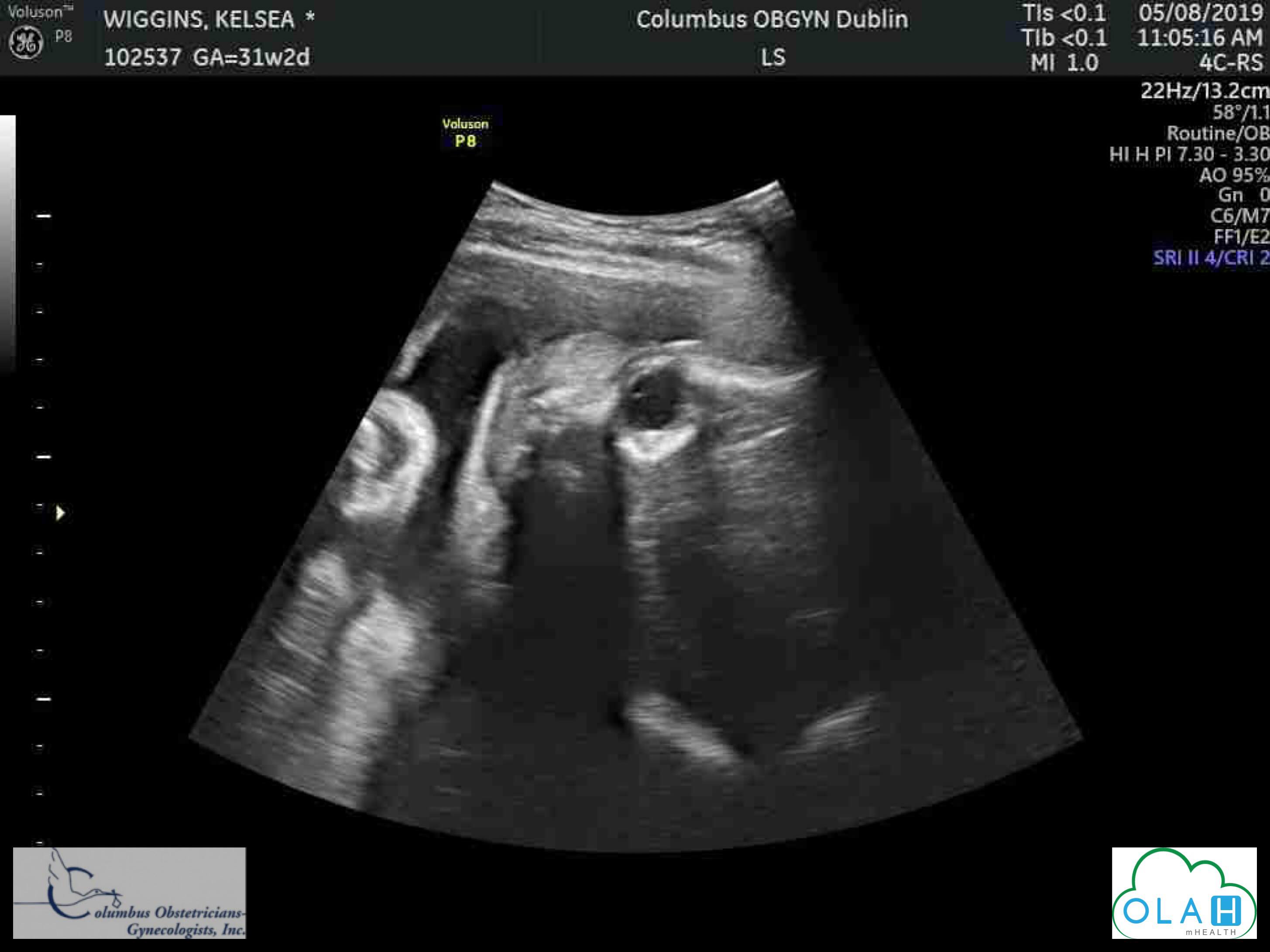 64208565_528714054334097_5489474065536122880_n (1)